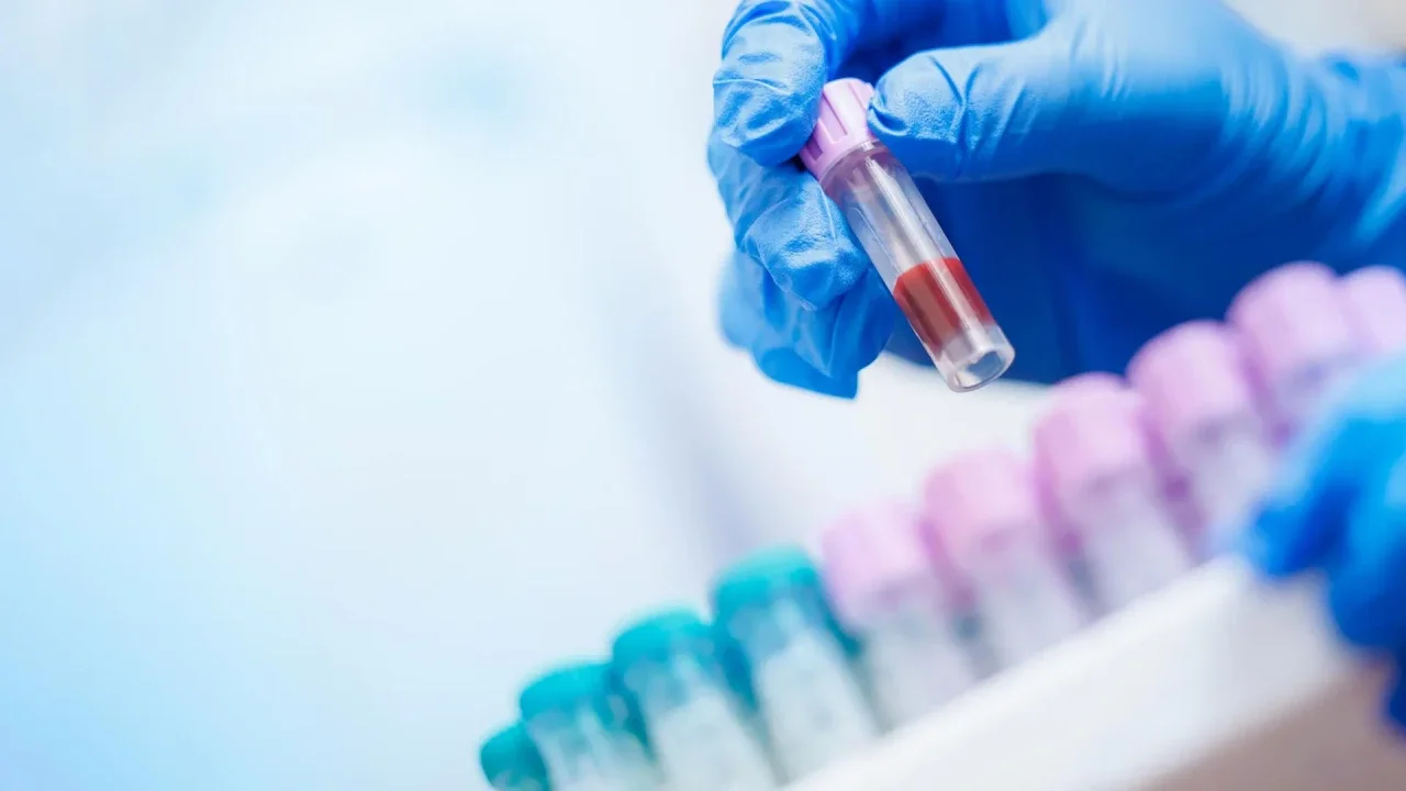AI breakthrough finds life-saving insights in everyday bloodwork